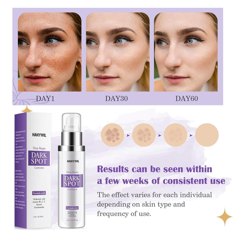 HANYWIL Dark Spot Remover for Face & Body Serum,Rapid Tone Repair Cream with Hyperpigmentation Treatment,Sun Spot, Age Spot & Melasma Remover,Dermatologist-Tested Brightening Retinol Serum (1.7 Fl Oz) Infinity Warehouse