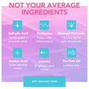 TULA Skin Care Keep It Clear Acne Foam Cleanser | Acne Treatment, Clear Up Acne, Prevent Breakouts & Brighten Marks, Contains Salicylic Acid and Probiotic Extracts | 6.3 fl. oz. TULA