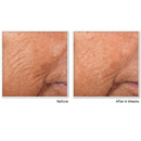 RoC Retinol Correxion Line Smoothing Night Serum Capsules, Daily Anti-Aging Skin Care Treatment, 10 Count RoC