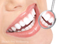 Teeth Whitening Gel Syringe Dispensers 22% Carbamide Peroxide, 10 Tooth Bleaching Gel 3ml Syringes Bleach Pro Whitening