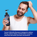 Psoriasis Shampoo, Seborrheic Dermatitis Folliculitis Shampoo, Anti-Fungal and Anti-Dandruff for Men and Women 300ml x 2pcs. Infinity Warehouse