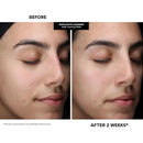Kate Somerville Pore-fect Skin Edit Travel Kit : ExfoliKate, EradiKate, & Goat Milk Cleanser Holiday Gift Set Infinity Warehouse