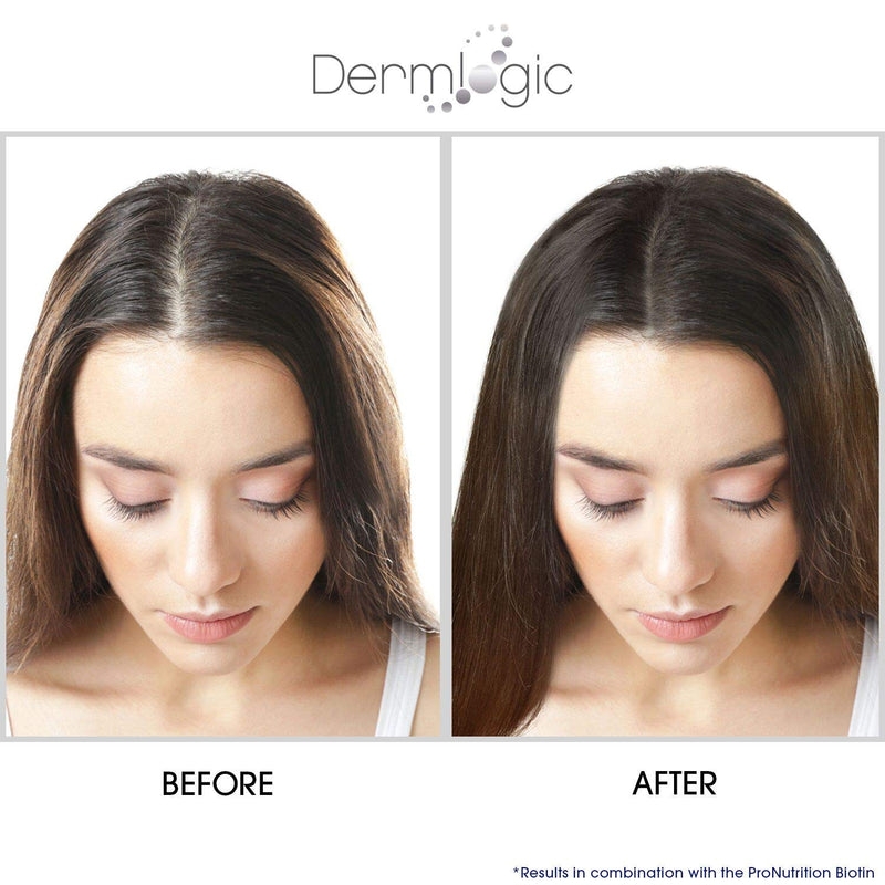 Hair Growth Serum-Extra Strength DHT Blocker - Stimulates & Repairs New Follicle Regrowth. Grow Stronger, Thicker, Fuller, Longer, Healthier Hair. For Men & Women with No Side Effects. Dermlogic