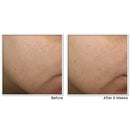 RoC Multi Correxion Revive + Glow Vitamin C Face Moisturizer, Anti-Aging Gel Cream, Hypo-Allegenic & Oil-Free Skin Care, 1.7 Ounce RoC