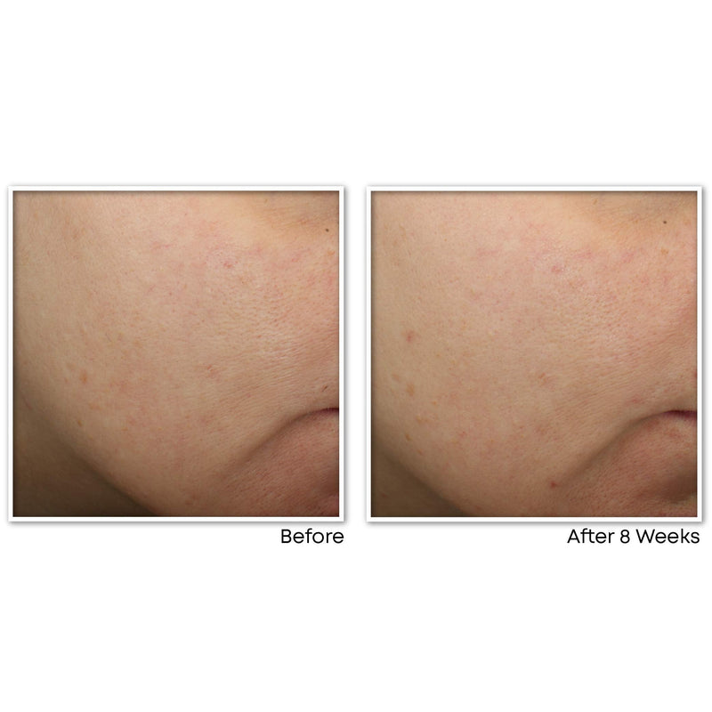 RoC Multi Correxion Revive + Glow Vitamin C Face Moisturizer, Anti-Aging Gel Cream, Hypo-Allegenic & Oil-Free Skin Care, 1.7 Ounce RoC