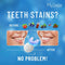 MySmile Teeth Whitening Kit with LED Light, 10 Min Non-Sensitive Fast Teeth Whitener with 3 Carbamide Peroxide Teeth Whitening Gel, Helps to Remove Stains from Coffee, Smoking, Wines, Soda, Food mysmile