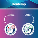 Dentemp Ora-GUARD Custom Fit Dental Guard - Bruxism Night Guard for Teeth Grinding - Mouth Guard for Clenching Teeth at Night - Comfortable Mouth Guard for Sleeping - Relieve Soreness in Jaw Muscles Dentemp Store
