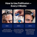 Follifusion Hair Microinfusion System – With Copper Peptide Serum Infinity Warehouse