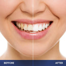 Luelli Teeth Whitening Kit with LED Light, Professional Teeth Whitening Formula with (3) Teeth Whitening Gel Syringes, (1) Desensitizing Gel | Mouth Tray | Mint Flavored at-Home Whitening Kit LUELLI