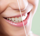 AMZ Professional Teeth Whitening Pen 2ml, Strong 44% Teeth Whitening Gel with Soft Applicator, No-Leak Cap, Compact Teeth Whitening Products for Home Use, Safe Teeth Whitener Pen for Sensitive Enamel AMZ Medical Supply