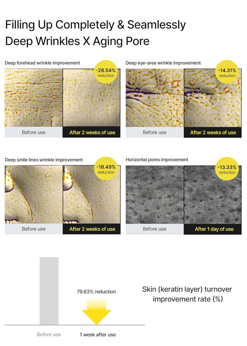 celimax The Vita A Retinal Shot Tightening Booster | with Retinal 0.1%, Matryxyl 3%, Pore Minimizer, Wrinkles & Fine Lines, Firmer Skin, 15ml Infinity Warehouse