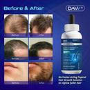 Minoxidil for Men Hair Growth Serum: Minoxidil 5 Percent - Hair Regrowth for Men - Minoxidil for Beard Growth - Hair Loss Treatments - Minoxidil 5% - Faster Thicker Stronger Hair Growth - 60ml Infinity Warehouse