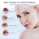 Retinol Under Eye Cream - Anti-Aging Treatment for Dark Circles, Puffiness & Wrinkles, Gentle Formula for Men & Women to Reduce Fine Lines, 0.7 Fl Oz Infinity Warehouse