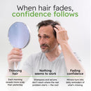 AlphaInfuse™ Scalp Nourishing Serum for Men – Ginseng & Eclipta Botanical Blend for Fuller-Looking, Thicker-Looking Hair and Healthy Scalp – 32ml – 2 Month Supply Infinity Warehouse