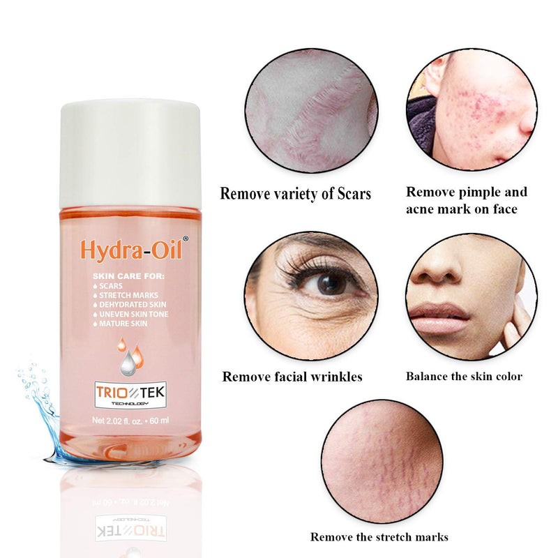 Hydra-Oil Scar Removal Serum - Scar Treatment for Face and Body - 50 ml Hydrating Oil for Acne Scar Remover, Stretch Mark Removal, and to Lighten Dark Spots - Vitamin E & A Hydra Oil