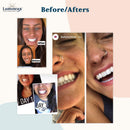 Lumineux Oral Essentials Teeth Whitening Kit - Includes 7 Treatments (14 Whitening Strips) | 1 Whitening Mouthwash, 1 Whitening Toothpaste & 1 Bamboo Toothbrush | Certified Non Toxic, Fluoride Free Oral Essentials