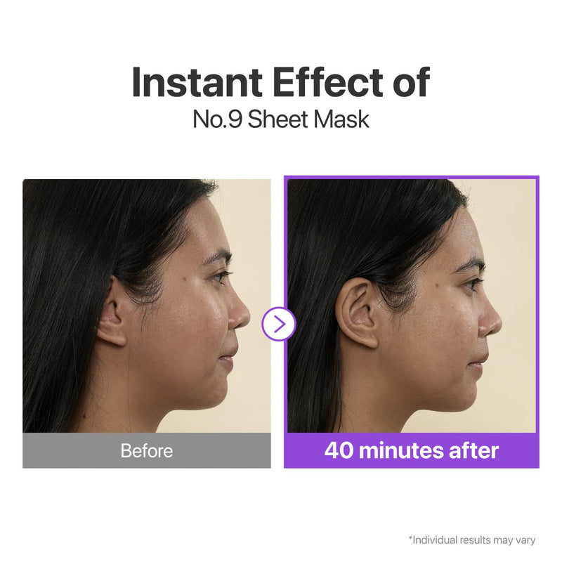 numbuzin No.9 Sheet Mask | NAD+ BIO Lifting-sil Full Face Mask | Improves Jawline, Jowls, Wrinkles, Neck Lines | Peptides, NAD+, Collagen | Skin Firmness | 4 Sheets + Lifting Band Infinity Warehouse