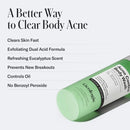 Geologie Acne Control Body Wash | Fresh Eucalyptus | 2% Salicylic Acid + 1.5% Glycolic Acid | Clears Body Acne & Prevents Breakouts | For Men & Women | No Benzoyl Peroxide | 8.4 oz Infinity Warehouse