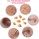 Blackhead Remover Pimple Popper Tool - Upmore Professional Pimple Comedone Extractor Popper Tool Acne Removal Kit for Removing Blackhead Whitehead Pimples Acne on Nose Face Skin with Carrying Box Upmore