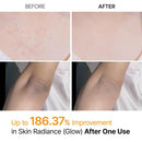 Dr.Melaxin Body Keratin Care Kojic Acid Turmeric Spray Gently Exfoliating Peeling Solution Korean Skincare All Skin Types 200ml Infinity Warehouse