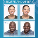 Instant Smile Complete Your Smile Tooth Replacement Kit with 3 Pack Fitting Beads Instant Smile