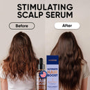 MOERIE Ultimate Hair Growth Serum for Natural Hair Regrowth & Thickening - Anti Thinning & Hair Loss Treatment for Women - Rapid Hair Growth Products - Scalp Oil Alternative - 1.69 fl oz / 50 ml Infinity Warehouse