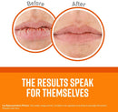 O'Keeffe's Lip Repair Lip Balm for Dry, Cracked Lips, Stick (Pack of 3: 1 Cooling + 1 Unscented + 1 SPF) O'Keeffe's Store