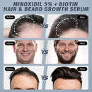 5% Minoxidil Spray for Hair Growth - Men & Women, Hair Thinning & Receding Hairline Treatment, with Rosemary for Faster & Thicker Hair Growth, Topical Aerosol 4 oz (Pack of 1) Infinity Warehouse