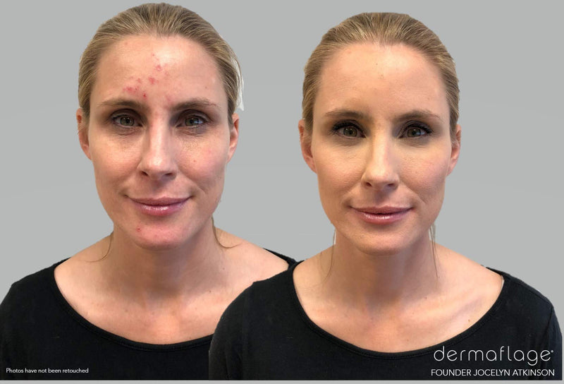 Waterproof Concealer Cream, Full Coverage Waterproof Makeup, Color Match Promise by Dermaflage, 6g/.2oz Dermaflage