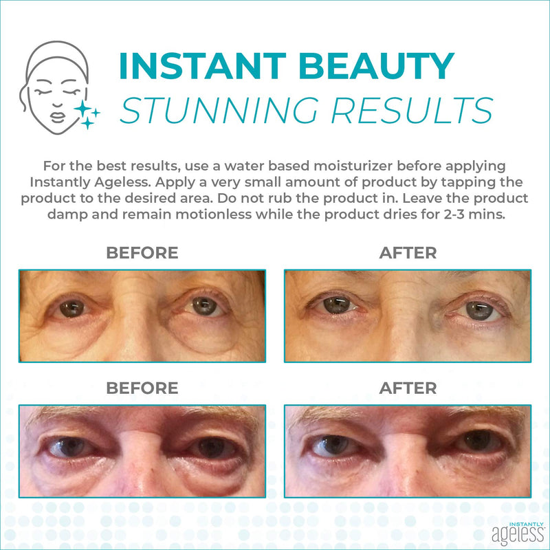 INSTANTLY AGELESS - Facelift In A Box Anti-Aging Face Cream for Forehead Wrinkles, Eyebrows, and Under-Eye Bags (10 Vials)… Instantly Ageless