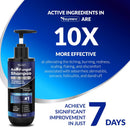 Psoriasis Shampoo, Seborrheic Dermatitis Folliculitis Shampoo, Anti-Fungal and Anti-Dandruff for Men and Women 300ml x 2pcs. Infinity Warehouse