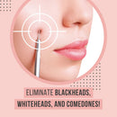 The Good Stuff Black Head Removal Tools with Mirrored Travel Case, 5 pcs Kit, Black The Good Stuff