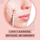 The Good Stuff Black Head Removal Tools with Mirrored Travel Case, 5 pcs Kit, Black The Good Stuff