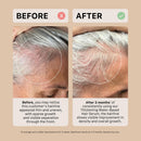 ACTIIV Thickening Hair Serum - Water Based | Supports the Appearance of Thicker, Fuller-Looking Hair, Lightweight Water-Based Formula, Non-Greasy, All Hair Types, 1.8 oz Infinity Warehouse