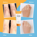 Underarm Cream - Effectively Brightening Cream - Brighten & Moisturizes Armpit, Neck, Knees, Private Parts - Body Moisturizer Intimate Skin Cream Elvanya