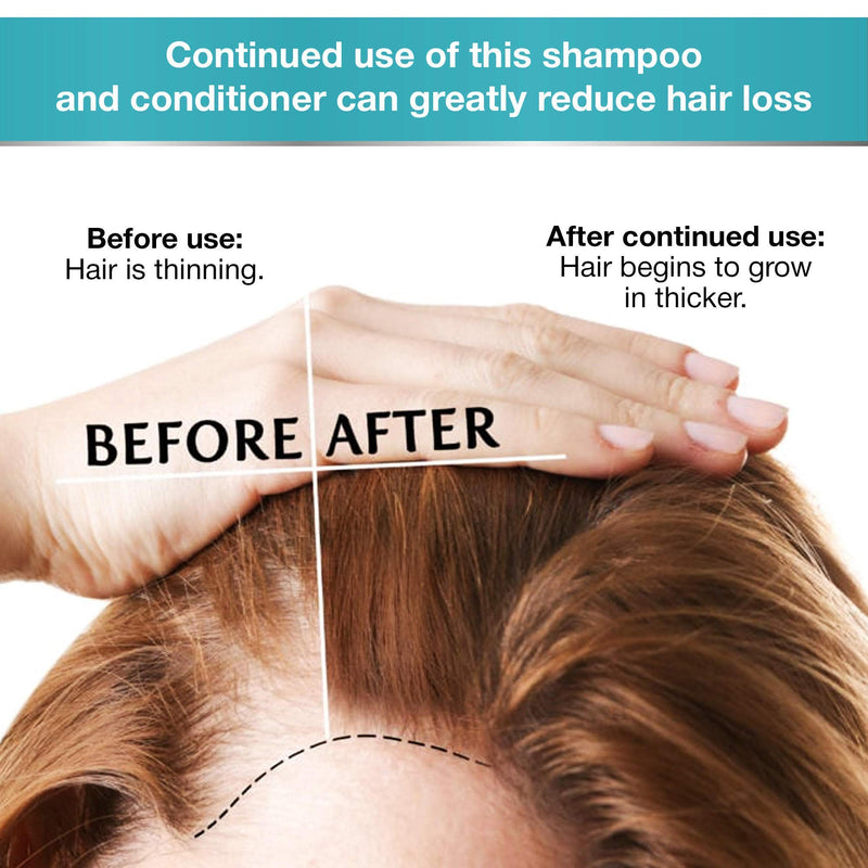 Biotin Shampoo and Conditioner and Hair Mask for Hair Growth - Thickening Anti Hair Loss Shampoo Treatment - Regrowth Shampoo & Conditioner & Hair Mask for Dry Normal Oily & Color Treated Hair BELLISSO