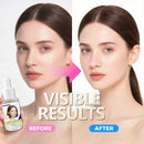 Milia Remover Treatment Serum 40ml,Milia Removal for Eyes & Face,Milia Acne Serum,Fat Granule Clearing Skin Essence Infinity Warehouse