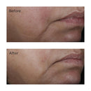 Perricone MD No:Rinse Intensive Pore Minimizing Toner, 4 fl. oz. Infinity Warehouse