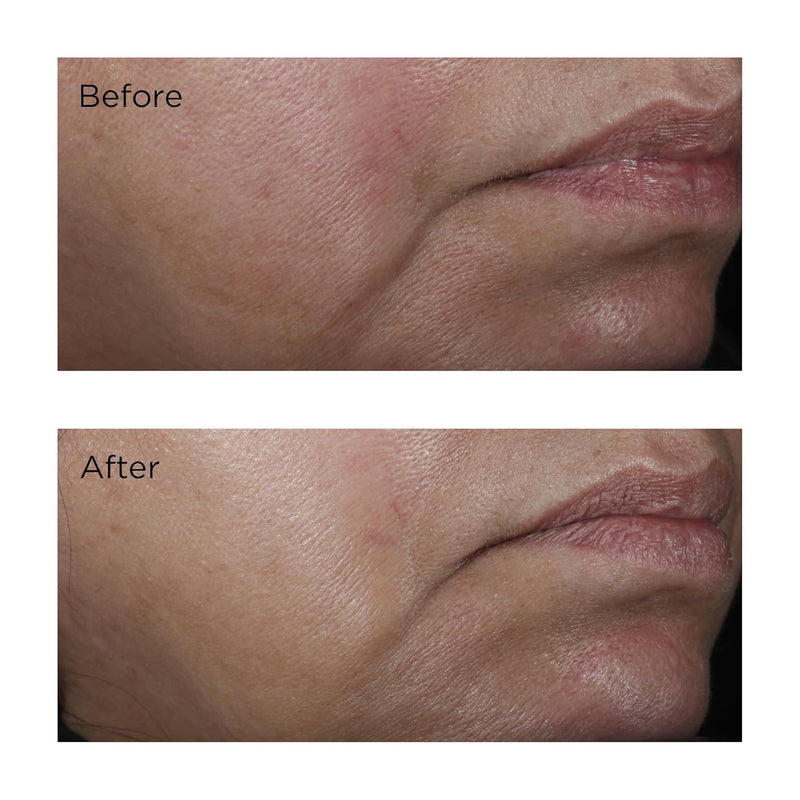 Perricone MD No:Rinse Intensive Pore Minimizing Toner, 4 fl. oz. Infinity Warehouse