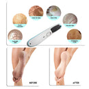 Electric Foot Callus Remover, Rechargeable Foot File Callus Remover with LED Light, Dead Skin Remover for Feet, Professional Pedi Foot Care Pedicure Tools for Women Men Hard Cracked Dry Skin (Blue) AM 8:00