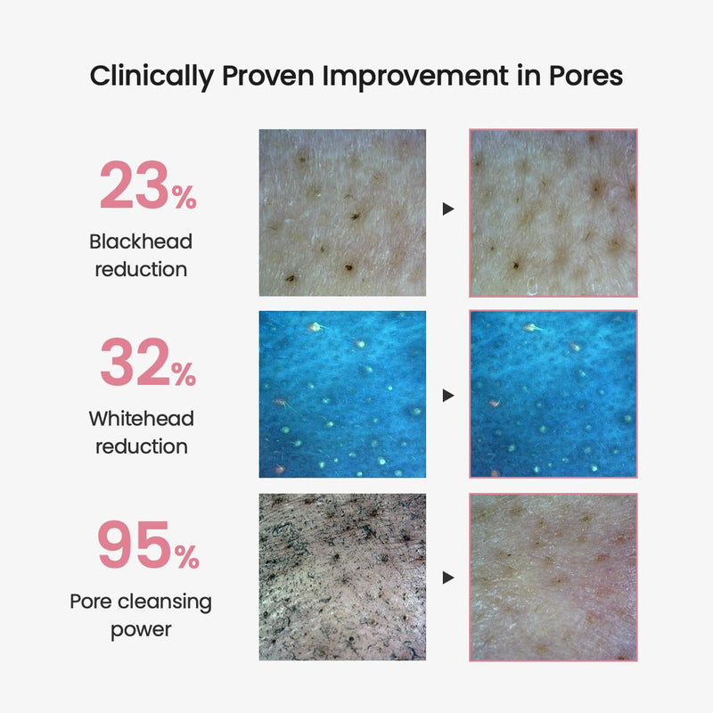 BIODANCE Collagen Cleansing Oil, Facial Oil Cleanser, Gentle Makeup Remover without Clogging Pores, Removes Bleackhed and Whitehead for Sensitive Skin, Oily Skin, Korean Skincareㅣ6.76 fl. oz. (200 ml) Infinity Warehouse