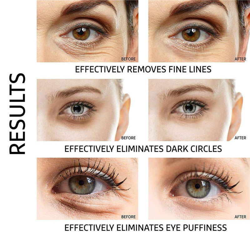 Adofect 30 Pairs White Eye Mask Power Crystal Gel Collagen Masks, Great For Anti Aging, Dark Circles & Puffiness Adofect Store