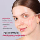 Niacinamide 10% + Tranexamic Acid 4% Serum, Arbutin 2%, Hyaluronic Acid, TXA Facial Serum, Glass Skin, Clarifying, Radiant Complexion with Natural Color, Korean Skin care, 33ml, 1.11 fl.oz. Infinity Warehouse