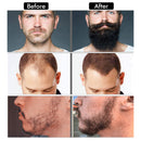 Beard Growth Kit - Derma Roller for Beard Growth, Beard Growth Serum Oil (2oz), Beard Balm and Comb, Stimulate Beard and Hair Growth - Gifts for Men Dad Him Boyfriend Husband Brother Naland