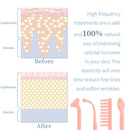 TUMAKOU Professional High Frequency Facial Machine - Face Skin Therapy Wand for Wrinkle Reducing, Skin Tightening, Anti Wrinkle, Dark Circles TUMAKOU