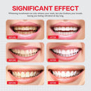 ID Stain Whitening Mouthwash, Gunk Removing Mouthwash for Fresh Breath, Hydrogen Peroxide Mouthwash to Promote Whiter Teeth, Peroxide Rinse with Essential Oils Infinity Warehouse