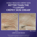 RoC Crepe Repair Anti Aging Daily Face Moisturizer & Neck Firming Cream (1.7 oz) + RoC Retinol Wrinkle Smoothing Capsules (7 CT), Skin Care Treatment RoC