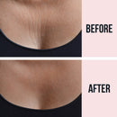 Sio Beauty SkinPad Silicone Chest Anti-Wrinkle Patches (2 Weeks Supply) - Reusable Overnight Smoothing Decollette Pad - Anti-Aging Patch For Neck & Cleavage SiO