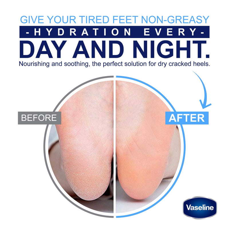 Vaseline Deep Moisture Foot Cream For Dry Cracked Feet & Heel, Non-Greasy Cracked Heel Cream, 1.94 OZ (Pack of 4) Vaseline