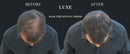 LUXE Hair Thickening Fibers - CONFIDENCE IN A JAR – 2 Months+ Supply! – Hypoallergenic, Dermatologist Tested – Multiple Colors Available (Black) LUXE Professional
